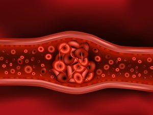 Danger of blood clots
