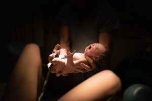 Oxygen Deprivation During Delivery